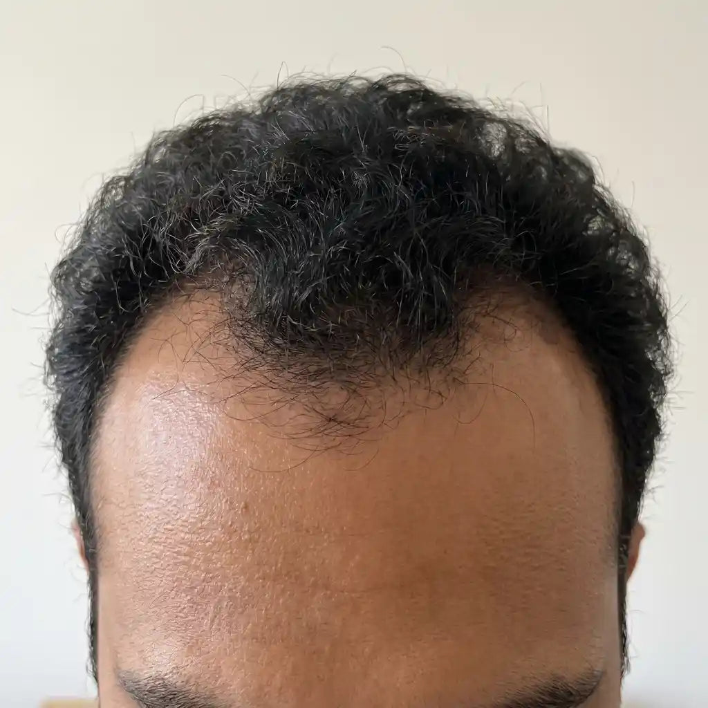 Before