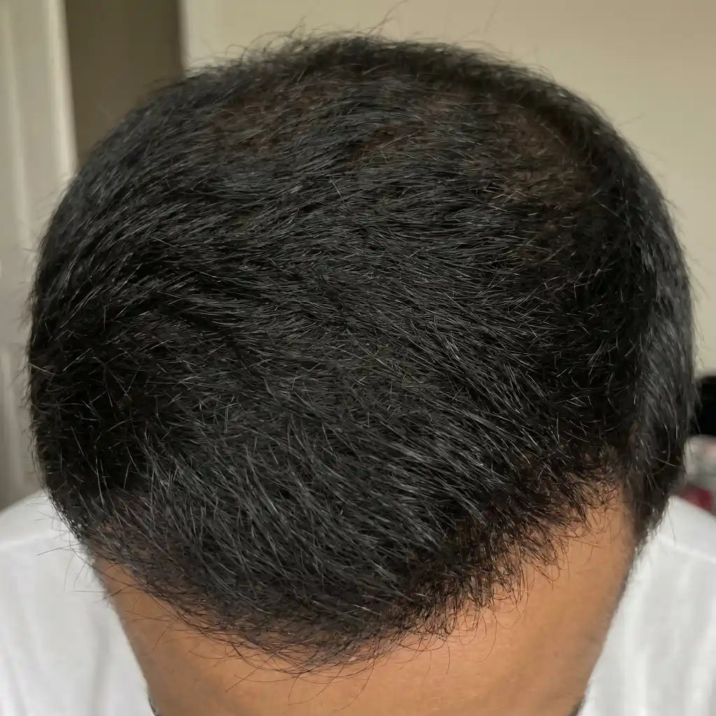 After