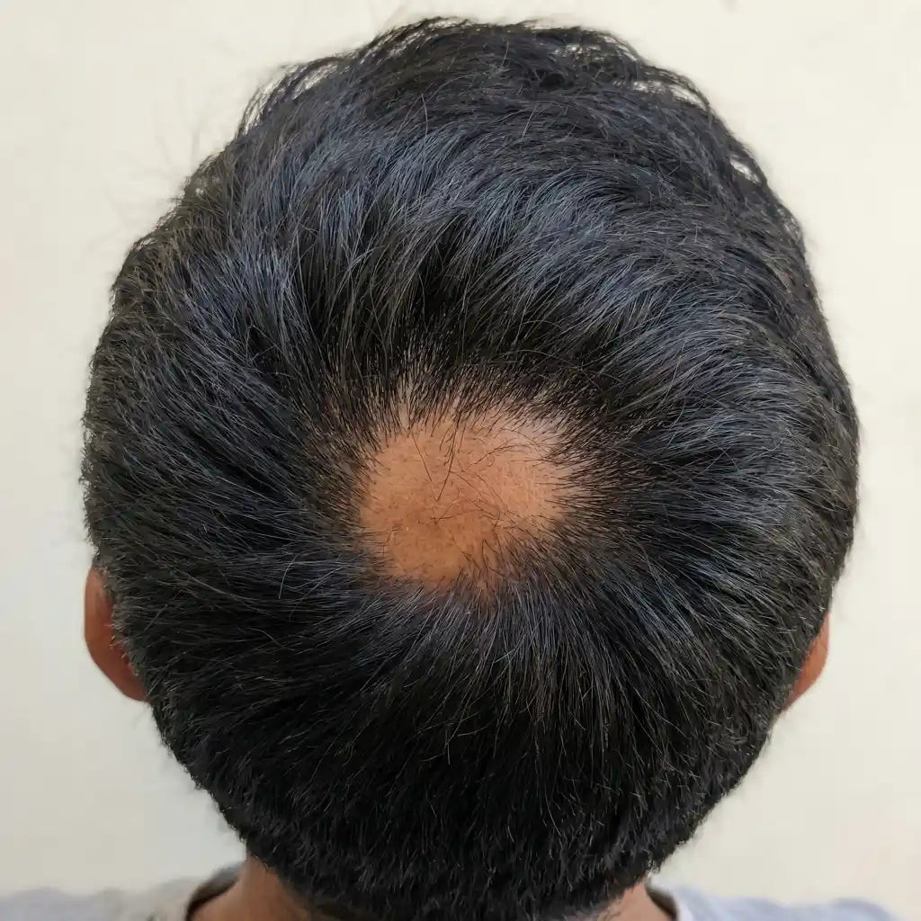 Before