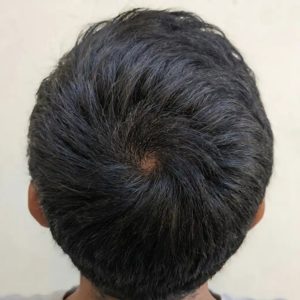 After