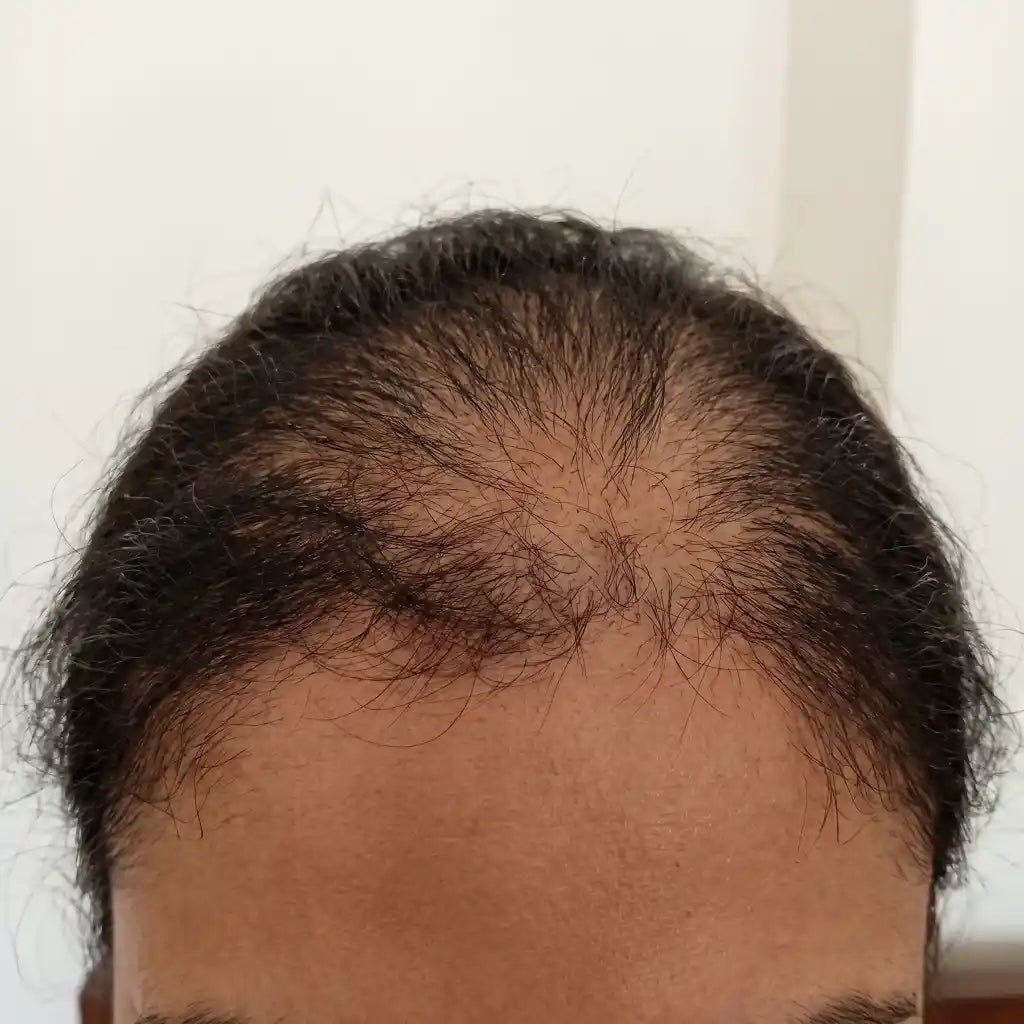 Before