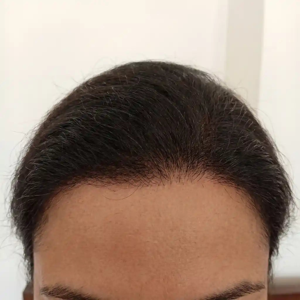After